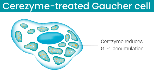 Cerezyme-treated Gaucher cell