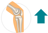 Illustration of a human knee showing the bones in the leg and an upward-pointing arrow next to it 